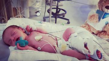 Preemie in Radiant Warmer