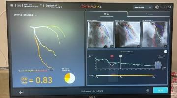 The CathWorks FFRangio® System uses computational science to visualize a patient’s heart.